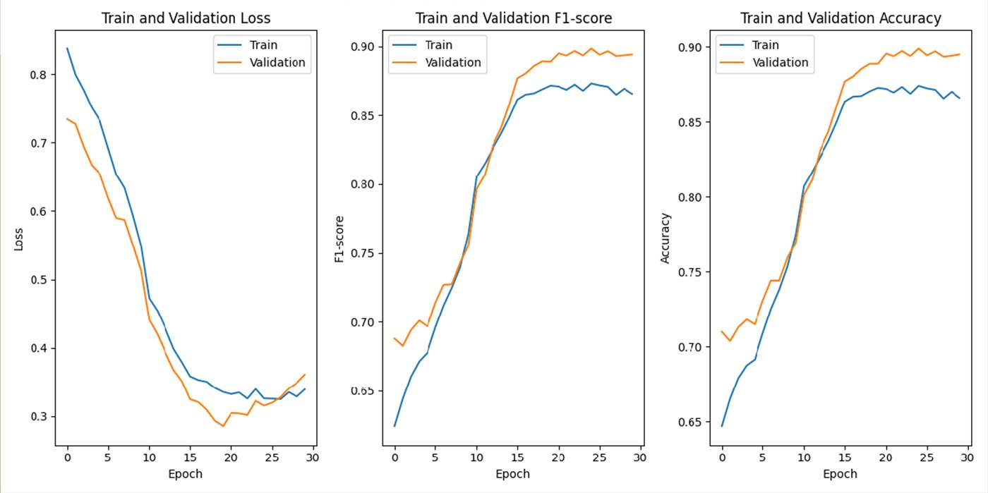 Train and validation loss, F1-score and accuracy curves for ResNet3D at learning rate 1e-4